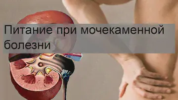 Питание при мочекаменной болезни